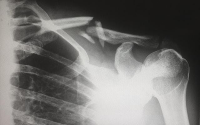 Greensboro Injury Lawyers